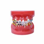 Dual Bracket Orthodontic Model – Half Metal, Half Ceramic