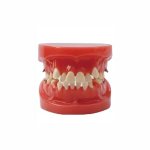 Orthodontic Malocclusion Model