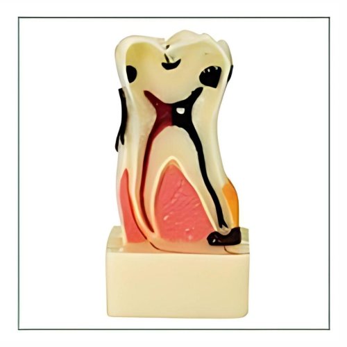 4X Enlarged Molar Anatomy Model