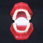 Orthodontic Model (After treatment)