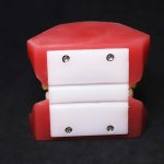 Orthodontic Model (After treatment)