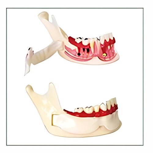 Mandible Cross-Section Model with Pathology