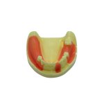 Surgical Implant Simulation Model – Mandible