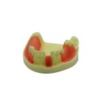Surgical Implant Simulation Model – Mandible