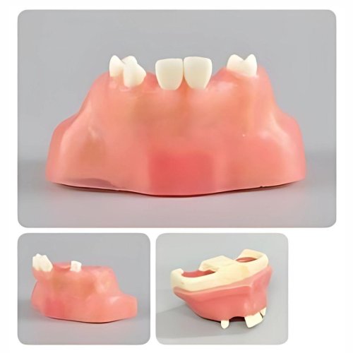 Sinus Lift Practice Model with Muccosa - Type 2