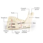 Fractured Mandible Fixation Model with Titanium Plates