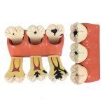 4X Enlarged Caries Developing Model