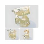 Pathologies Model - Adult