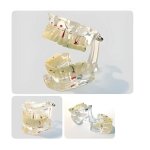 Pathologies Model - Pediatric