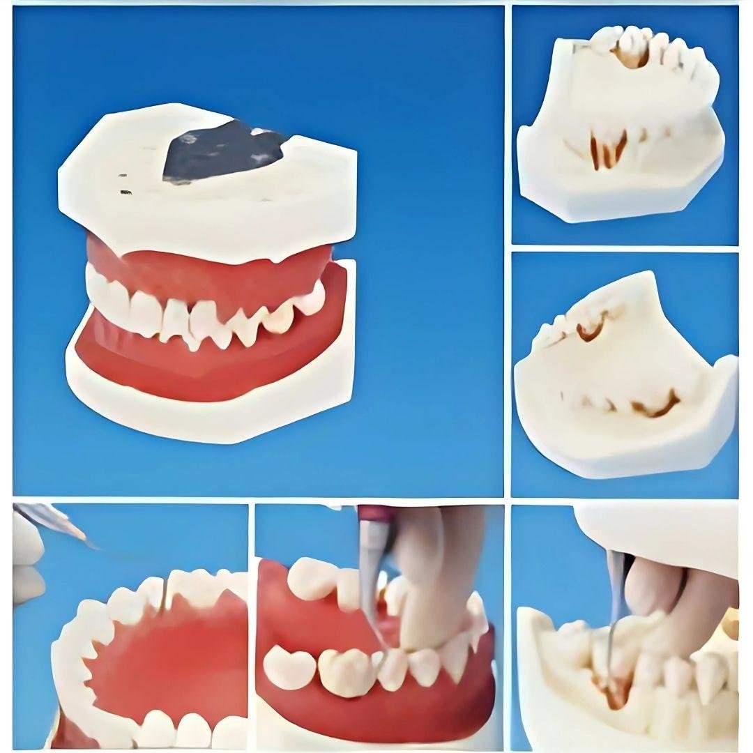 Dental Products